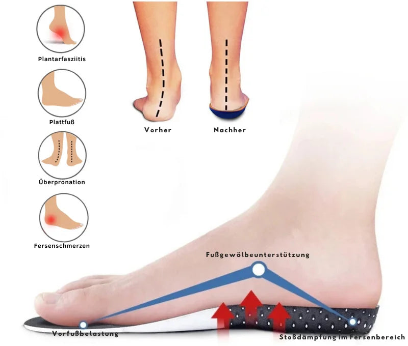 Insoles – Instant Relief from Footpain